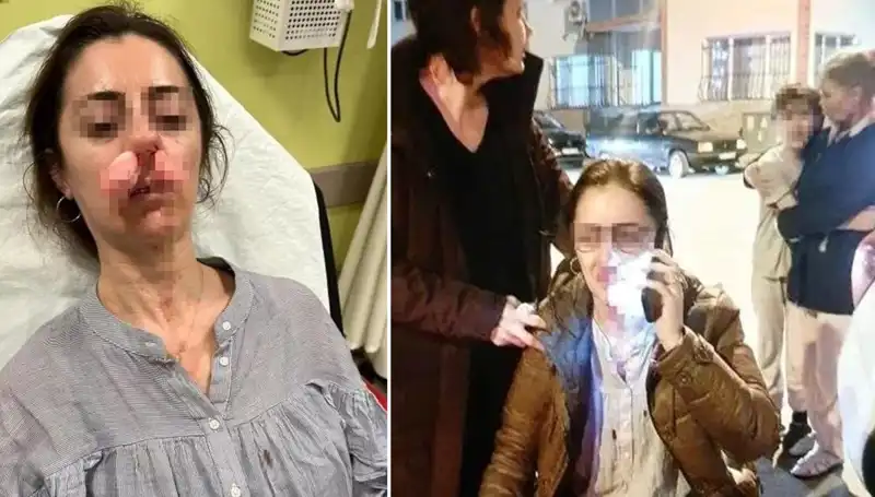 Otomobil Kapısı Silah Sayıldı: Kıskançlık Krizinde Şok Olay