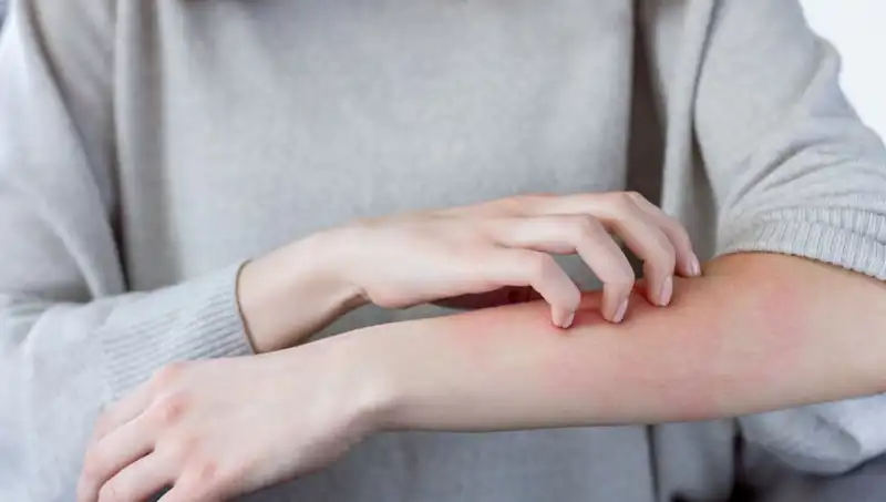 Cilt Kanseri Tehlikesi: Dermatologdan İki Gözden Kaçırılan Belirti Açıklaması