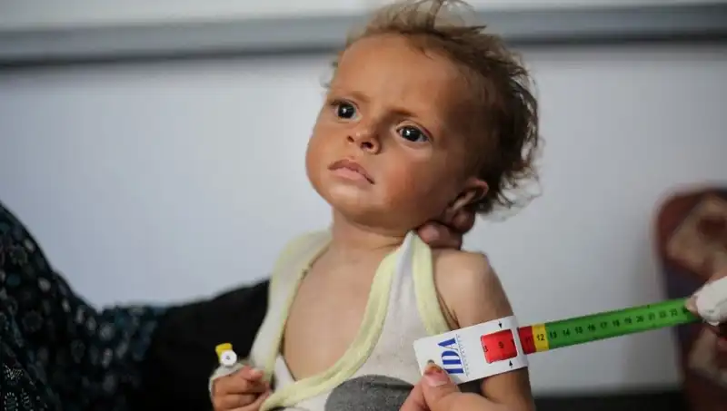 İngiltere, Gazze'deki 300 Çocuğa Yeni Fırsatlar Sunacak