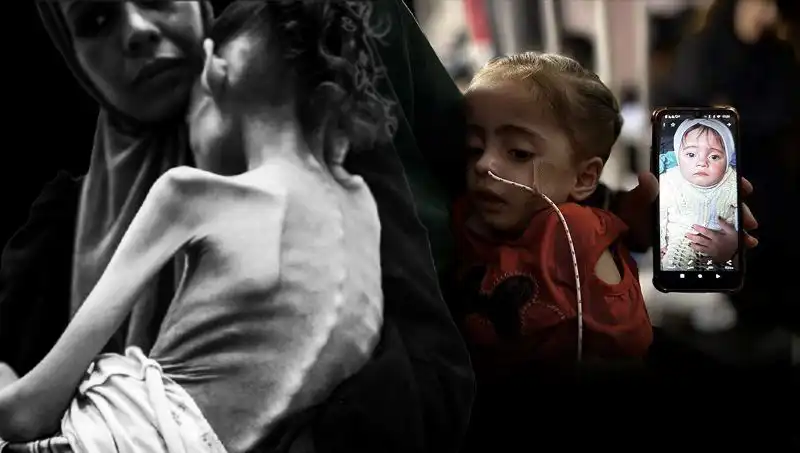Küçük Meryem'in Açlıkla Mücadelesi: 25 Kilodan 10 Kiloya Düşmesi